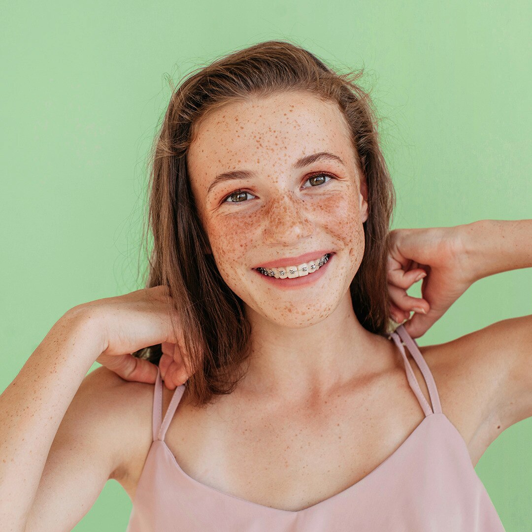 Dove Self-Esteem Project
