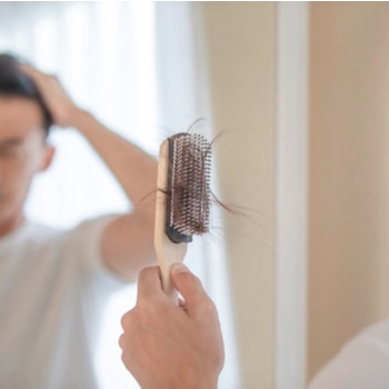Cara Mengatasi Rambut Rontok dan Ketombe Pada Pria
