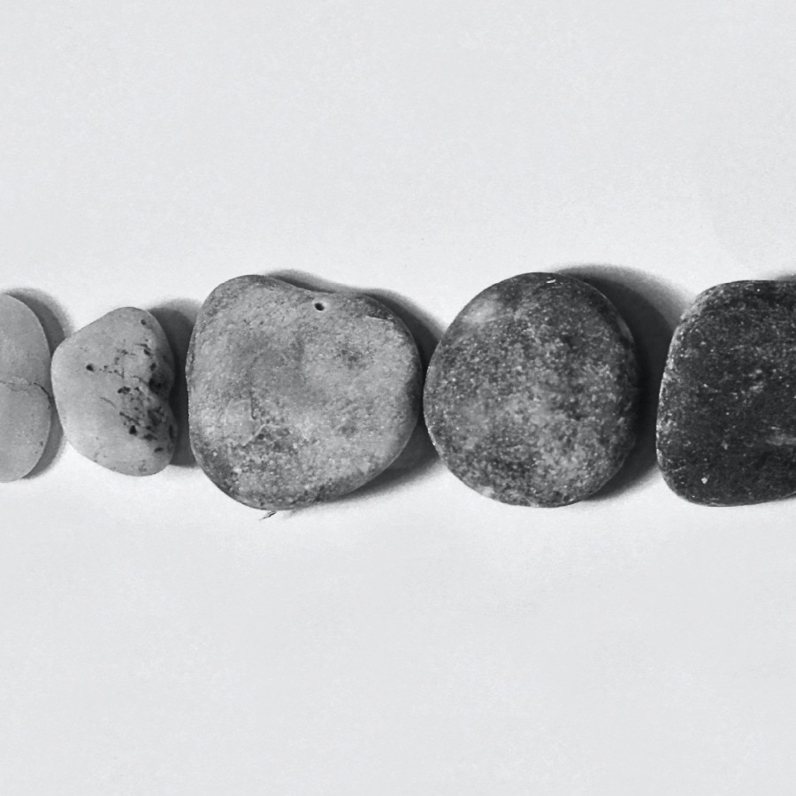 Black stains on teeth: causes and solutions