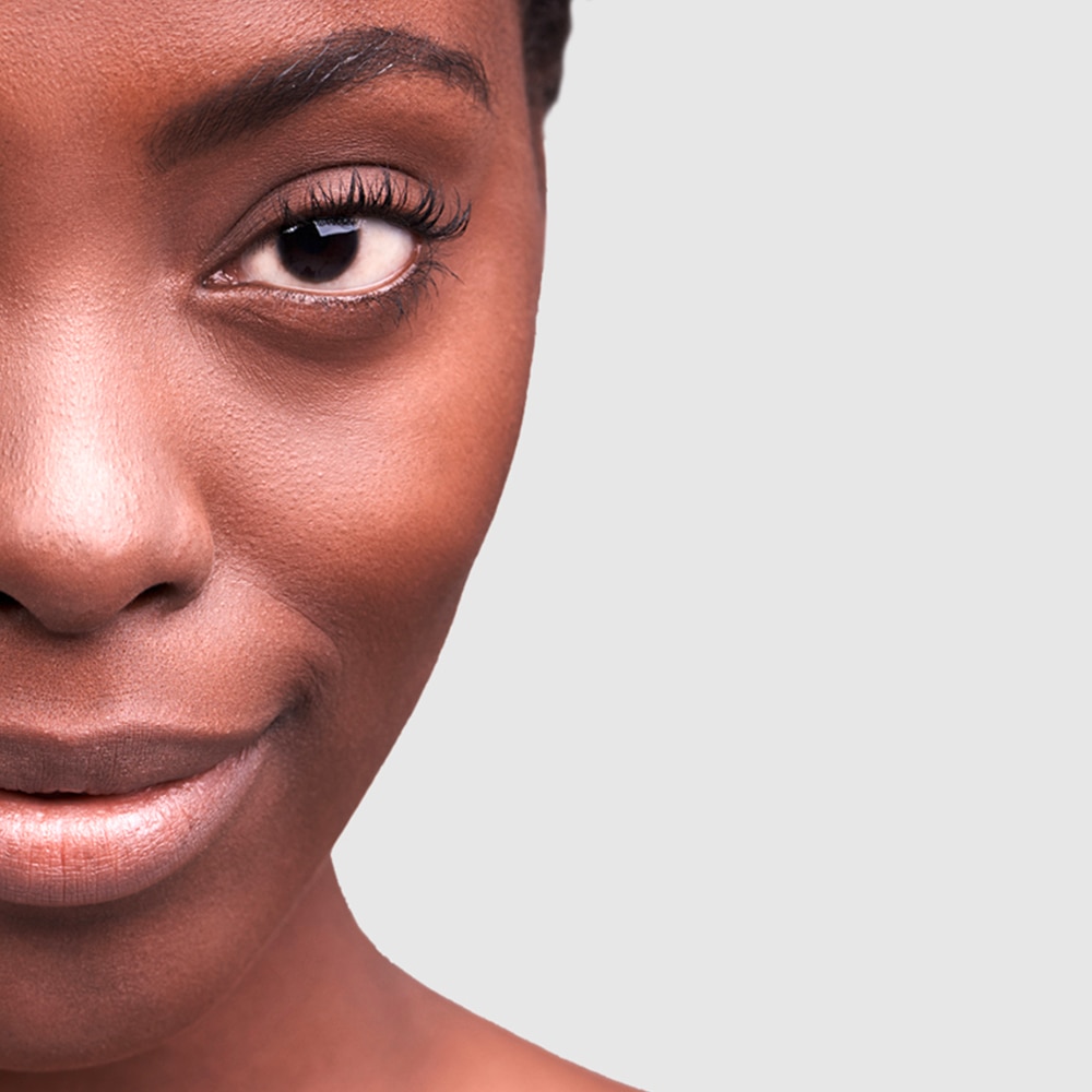 A young woman with uneven skin tone