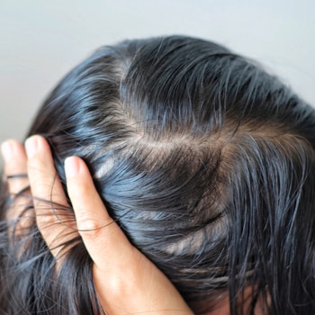 rambut lepek