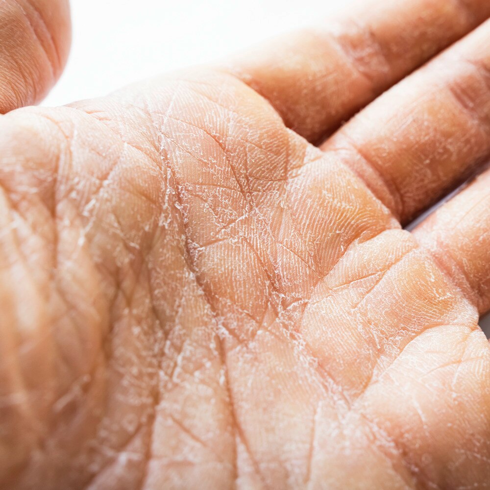 Close up of dry hands