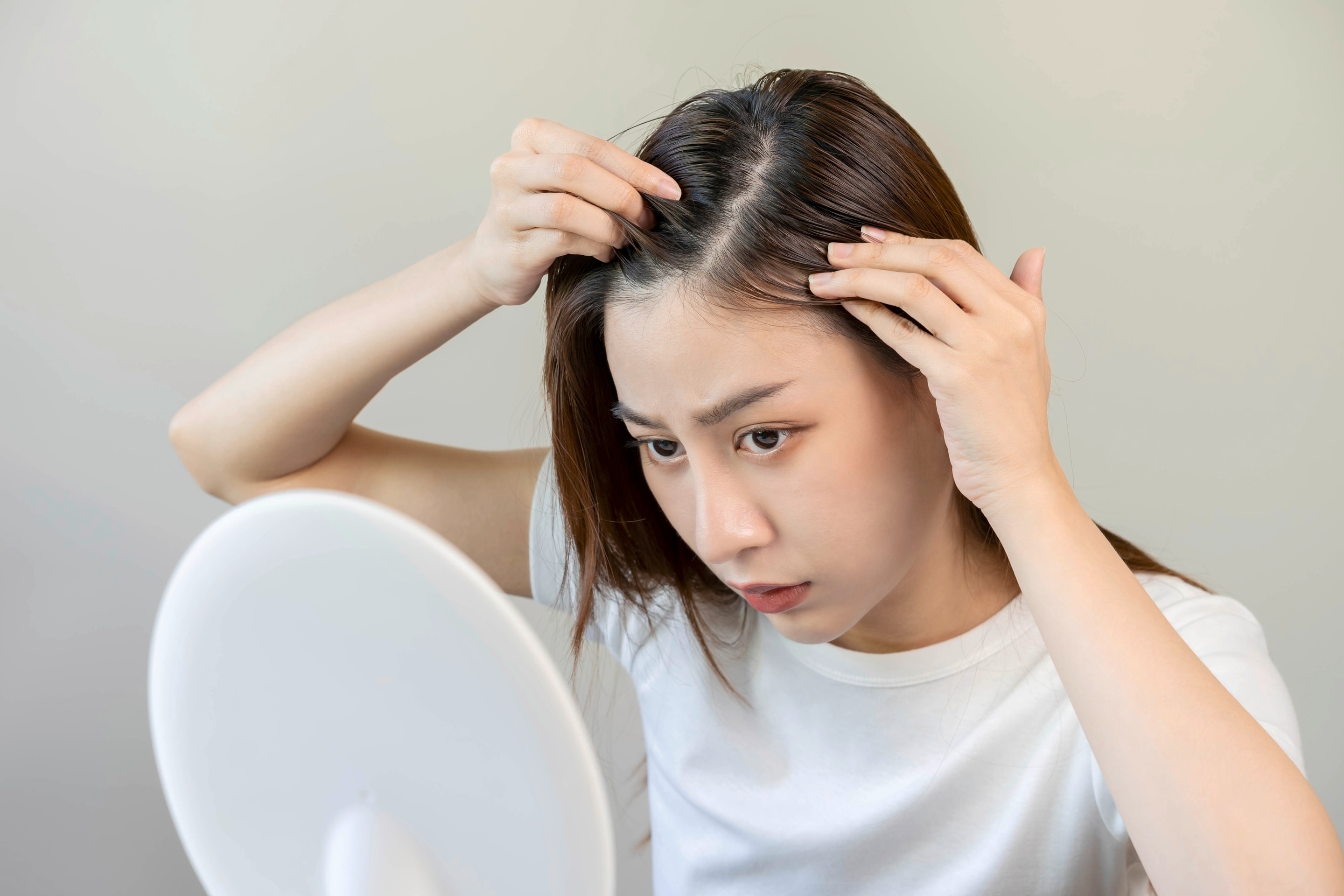6 Masalah Rambut Akibat Kulit Kepala Tak Terawat